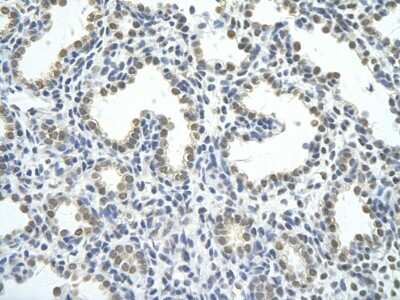 Immunohistochemistry-Paraffin: hnRNP AB Antibody [NBP2-87581] - Rabbit Anti-HNRPAB antibody. Paraffin Embedded Tissue: Human Lung. Cellular Data: alveolar cell. Antibody Concentration: 4.0-8.0 ug/ml. Magnification: 400X