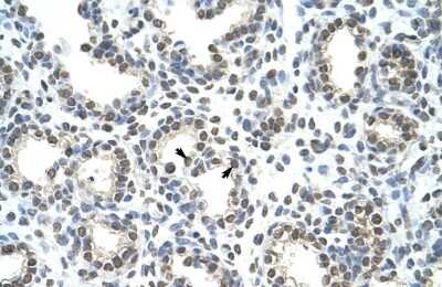 Immunohistochemistry-Paraffin: hnRNP AB Antibody [NBP2-87582] - Rabbit Anti-HNRPAB Antibody. Paraffin Embedded Tissue: Human Lung. Cellular Data: Alveolar cells. Antibody Concentration: 4.0-8.0 ug/ml. Magnification: 400X