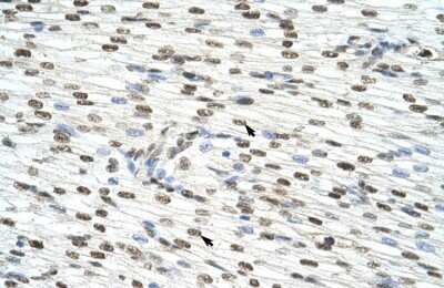Immunohistochemistry-Paraffin: hnRNP AB Antibody [NBP2-87582] - Rabbit Anti-HNRPAB Antibody. Paraffin Embedded Tissue: Human Heart. Cellular Data: Myocardial cells. Antibody Concentration: 4.0-8.0 ug/ml. Magnification: 400X