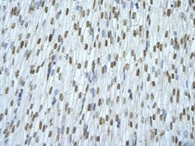 Immunohistochemistry-Paraffin: hnRNP AB Antibody [NBP2-87582] - Rabbit Anti-HNRNPAB Antibody. Paraffin Embedded Tissue: Human cardiac cell. Cellular Data: Epithelial cells of renal tubule. Antibody Concentration: 4.0-8.0 ug/ml. Magnification: 400X