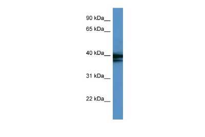 Western Blot: hnRNP AB Antibody [NBP2-87581] - WB Suggested Anti-HNRPAB Antibody Titration: 0.2-1 ug/ml. ELISA Titer: 1:62500. Positive Control: COLO205 cell lysate HNRNPAB is supported by BioGPS gene expression data to be expressed in COLO205