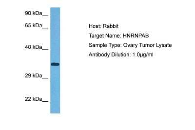 Western Blot: hnRNP AB Antibody [NBP2-87583] - Host: Rabbit. Target Name: HNRNPAB. Sample Tissue: Human Ovary Tumor lysates. Antibody Dilution: 1ug/ml