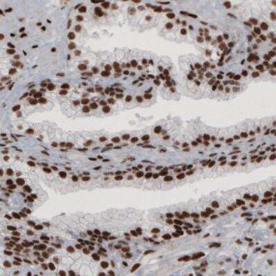 Immunohistochemistry: hnRNP C1 + C2 Antibody (CL2593) [NBP2-36776] - Staining of human prostate shows strong nuclear positivity in glandular and connective tissue cells.