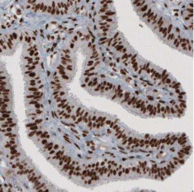 Immunohistochemistry: hnRNP C1 + C2 Antibody (CL2593) [NBP2-36776] - Staining of human fallopian tube shows strong nuclear immunoreactivity.