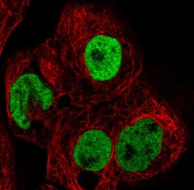 Immunocytochemistry/Immunofluorescence: hnRNP C1 + C2 Antibody (CL2596) [NBP2-36777] - Staining of human cell line A431 showing distinct nuclear (without nucleoli)Staining in green. Microtubule-staining and nuclear probes are visualized in red and blue respectively (where available). Antibody staining is shown in green.