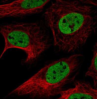 Immunocytochemistry/Immunofluorescence: hnRNP C1 + C2 Antibody (CL2596) [NBP2-36777] - Staining in U2OS cell line with Anti-HNRNPC monoclonal antibody, showing distinct nuclear (without nucleoli)Staining in green. Microtubule-staining and nuclear probes are visualized in red and blue respectively (where available). Antibody staining is shown in green.