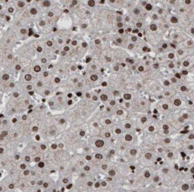 Immunohistochemistry: hnRNP C1 + C2 Antibody (CL2596) [NBP2-36777] - Staining of human liver shows nuclear immunoreactivity in hepatocytes.