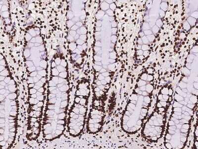 Immunohistochemistry-Paraffin: hnRNP C1 + C2 Antibody [NBP2-98634] - Immunochemical staining of human hnRNP C1 + C2 in human rectum with rabbit polyclonal antibody at 1:100 dilution, formalin-fixed paraffin embedded sections.