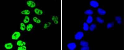 Immunocytochemistry/Immunofluorescence: hnRNP C1 + C2 Antibody (SN0652) [NBP2-67656] - Staining hnRNP C1+C2 in Hela cells (green). The nuclear counter stain is DAPI (blue). Cells were fixed in paraformaldehyde, permeabilised with 0.25% Triton X100/PBS.