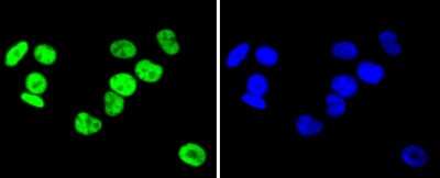 Immunocytochemistry/Immunofluorescence: hnRNP C1 + C2 Antibody (SN0652) [NBP2-67656] - Staining hnRNP C1+C2 in MCF-7 cells (green). The nuclear counter stain is DAPI (blue). Cells were fixed in paraformaldehyde, permeabilised with 0.25% Triton X100/PBS.