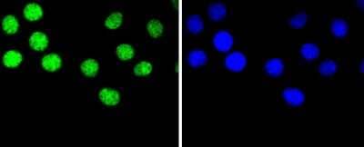 Immunocytochemistry/Immunofluorescence: hnRNP C1 + C2 Antibody (SN0652) [NBP2-67656] - Staining hnRNP C1+C2 in B16-F1 (green). The nuclear counter stain is DAPI (blue). Cells were fixed in paraformaldehyde, permeabilised with 0.25% Triton X100/PBS.