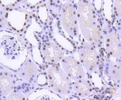 Immunohistochemistry-Paraffin: hnRNP C1 + C2 Antibody (SN0652) [NBP2-67656] - Analysis of paraffin-embedded human kidney tissue using anti-hnRNP C1+C2 antibody. Counter stained with hematoxylin.