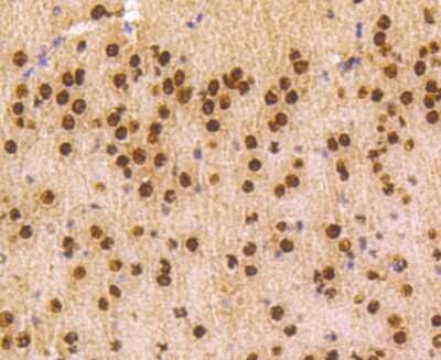 Immunohistochemistry-Paraffin: hnRNP C1 + C2 Antibody (SN0652) [NBP2-67656] - Analysis of paraffin-embedded mouse brain tissue using anti-hnRNP C1+C2 antibody. Counter stained with hematoxylin.