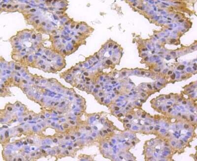 Immunohistochemistry-Paraffin: hnRNP C1 + C2 Antibody (SN0652) [NBP2-67656] - Analysis of paraffin-embedded mouse placenta tissue using anti-hnRNP C1+C2 antibody. Counter stained with hematoxylin.