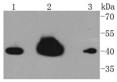 Western Blot: hnRNP C1 + C2 Antibody (SN0652) [NBP2-67656] - Analysis of hnRNP C1+C2 on different lysates using anti-hnRNP C1+C2 antibody at 1/1,000 dilution. Positive control: Lane 1: Hela Lane 2: MCF-7 Lane 3: HepG2