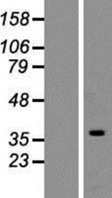 Western Blot: hnRNP C1 + C2 Overexpression Lysate (Adult Normal) [NBP2-10643] Left-Empty vector transfected control cell lysate (HEK293 cell lysate); Right -Over-expression Lysate for hnRNP C1 + C2.