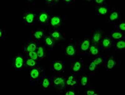 Immunocytochemistry/Immunofluorescence: hnRNP F Antibody (5F5) [NBP2-02221] Staining of COS7 cells transiently transfected by pCMV6-ENTRY hnRNP F.