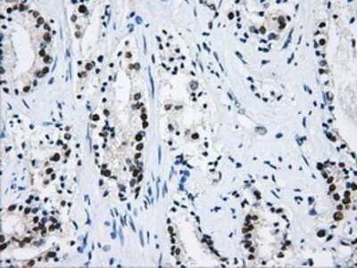 Immunohistochemistry-Paraffin: hnRNP F Antibody (5F5) [NBP2-02221] - Staining of paraffin-embedded Human prostate tissue using anti-hnRNP F mouse monoclonal antibody.