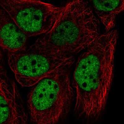 Immunocytochemistry/Immunofluorescence: hnRNP F Antibody [NBP2-57442] - Staining of human cell line HaCaT shows localization to nucleoplasm.