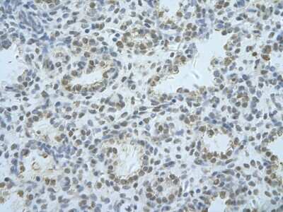 Immunohistochemistry: hnRNP F Antibody [NBP1-57273] - Human alveolar cell Cellular data: Epithelial cells of renal tubule Antibody Concentration: 4.0-8.0 ug/ml Magnification: 400X.