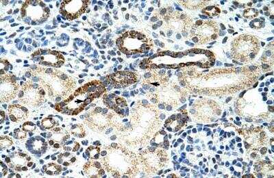 Immunohistochemistry-Paraffin: hnRNP F Antibody [NBP1-57273] - Human kidney Tissue, antibody concentration 4-8ug/ml. Cells with positive label: renal corpuscle cells (indicated with arrows) 400X magnification.