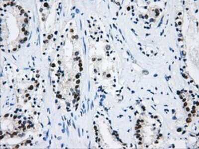 Immunohistochemistry: hnRNP F Antibody (OTI5F5) - Azide and BSA Free [NBP2-70907] - Staining of paraffin-embedded Human prostate tissue using anti-hnRNP F mouse monoclonal antibody.