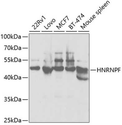 Western Blot: hnRNP F Antibody [NBP3-03421] - Analysis of extracts of various cell lines, using hnRNP F antibody at 1:1000 dilution. Secondary antibody: HRP Goat Anti-Rabbit IgG (H+L) at 1:10000 dilution. Lysates/proteins: 25ug per lane. Blocking buffer: 3% nonfat dry milk in TBST. Detection: ECL Basic Kit.