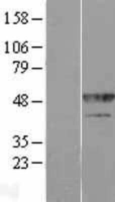 Western Blot: hnRNP F Overexpression Lysate (Adult Normal) [NBP2-10930] Left-Empty vector transfected control cell lysate (HEK293 cell lysate); Right -Over-expression Lysate for hnRNP F.