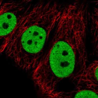 Immunocytochemistry/Immunofluorescence: hnRNP G Antibody [NBP2-34152] - Staining of human cell line MCF7 shows localization to nucleoplasm. Antibody staining is shown in green.