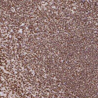 Immunohistochemistry-Paraffin: hnRNP G Antibody [NBP2-34152] - Staining of human tonsil shows strong nuclear positivity in non-germinal center cells.