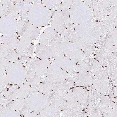 Immunohistochemistry-Paraffin: hnRNP G Antibody [NBP2-34152] - Staining of human skeletal muscle shows strong nuclear positivity in myocytes.
