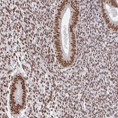 Immunohistochemistry-Paraffin: hnRNP G Antibody [NBP2-34152] - Staining of human endometrium shows strong nuclear positivity.