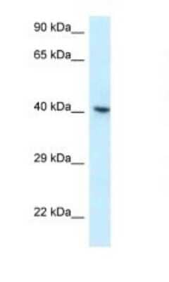 Western Blot: hnRNP G Antibody [NBP1-79904] - Titration: 1.0 ug/ml Positive Control: OVCAR-3 Whole Cell.