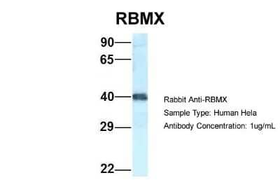 Western Blot hnRNP G Antibody