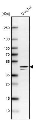 Western Blot: hnRNP G Antibody [NBP2-34152] - Analysis in human cell line MOLT-4.