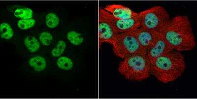 Immunocytochemistry/Immunofluorescence: hnRNP H Antibody [NBP1-31648] - A431 cells were fixed in 4% paraformaldehyde at RT for 15 min. Green: hnRNP H protein stained by hnRNP H antibody [N1C1] diluted at 1:500.Red: alpha Tubulin, a cytoskeleton marker, stained by alpha Tubulin antibody [114]  (NBP2-43837) diluted at 1:1000. Blue: Hoechst 33342 staining.