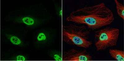 Immunocytochemistry/Immunofluorescence: hnRNP H Antibody [NBP1-31648] - HeLa cells were fixed in 4% paraformaldehyde at RT for 15 min. Green: hnRNP H protein stained by hnRNP H antibody [N1C1] diluted at 1:200. Red: alpha Tubulin, a cytoskeleton marker, stained by alpha Tubulin antibody [B-5-1-2]  diluted at 1:10000. Blue: Hoechst 33342 staining.