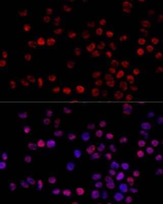 Immunocytochemistry/Immunofluorescence: hnRNP H Antibody [NBP2-93590] - Analysis of 293T cells using hnRNP H . Blue: DAPI for nuclear staining.