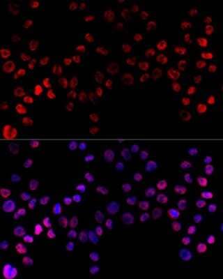 Immunocytochemistry/Immunofluorescence: hnRNP H Antibody [NBP2-93590] - Immunofluorescence analysis of 293T cells using hnRNP H antibody (NBP2-93590) at dilution of 1:100 (40x lens). Blue: DAPI for nuclear staining.