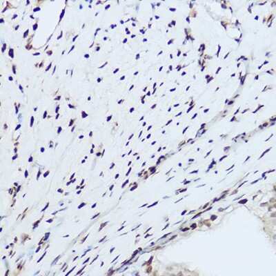 Immunohistochemistry-Paraffin: hnRNP H Antibody [NBP2-93590] - Immunohistochemistry of paraffin-embedded rat ovary using hnRNP H Rabbit pAb (NBP2-93590) at dilution of 1:100 (40x lens). Perform high pressure antigen retrieval with 10 mM citrate buffer pH 6.0 before commencing with IHC staining protocol.