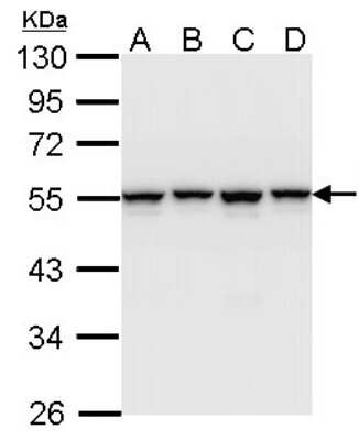 Western Blot: hnRNP H Antibody [NBP1-31648] - Sample (30 ug of whole cell lysate) A: A431 B: H1299 C: Hela D: Hep G2 10% SDS PAGE; antibody diluted at 1:1000.