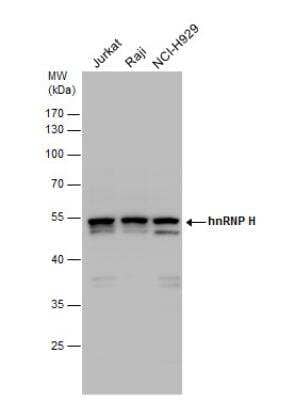 Western Blot: hnRNP H Antibody [NBP1-31648] - Various whole cell extracts (30 ug) were separated by 10% SDS-PAGE, and the membrane was blotted with hnRNP H antibody diluted by 1:1000.