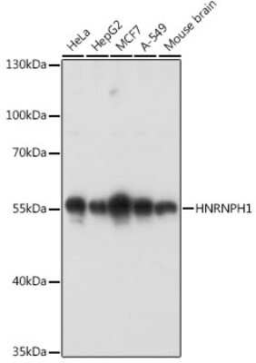 Western Blot: hnRNP H Antibody [NBP2-93590] - Western blot analysis of extracts of various cell lines, using hnRNP H antibody (NBP2-93590) at 1:3000 dilution. Secondary antibody: HRP Goat Anti-Rabbit IgG (H+L) at 1:10000 dilution. Lysates/proteins: 25ug per lane. Blocking buffer: 3% nonfat dry milk in TBST. Detection: ECL Basic Kit. Exposure time: 90s.