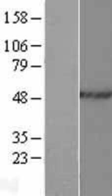 Western Blot: hnRNP H2 Overexpression Lysate (Adult Normal) [NBP2-11220] Left-Empty vector transfected control cell lysate (HEK293 cell lysate); Right -Over-expression Lysate for hnRNP H2.