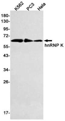 Western Blot: hnRNP K/J Antibody (S07-5H0) [NBP3-14943] - Western blot detection of hnRNP K/J in K562, PC3, Hela cell lysates using hnRNP K/J Rabbit mAb (1:500 diluted). Predicted band size: 51kDa. Observed band size: 62kDa.