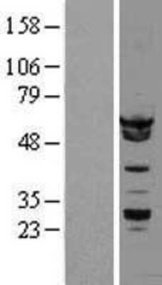 Western Blot hnRNP K Overexpression Lysate