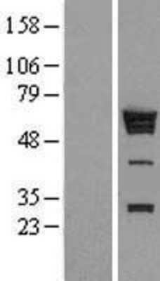 Western Blot hnRNP K Overexpression Lysate