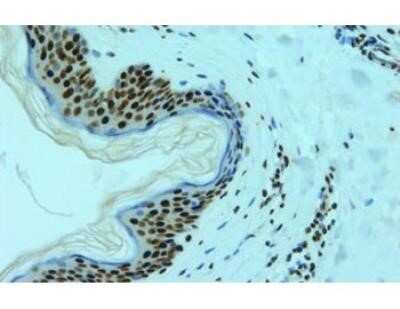 Immunohistochemistry: hnRNP L Antibody (4D11) - Azide and BSA Free [NBP2-80778] - Immunohistochemistry-Frozen: hnRNP L Antibody (4D11) [NB120-6106] Image from the standard format of this antibody.