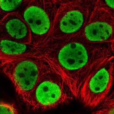 Immunocytochemistry/Immunofluorescence: hnRNP L Antibody [NBP2-38675] - Staining of human cell line MCF7 shows localization to nucleoplasm.