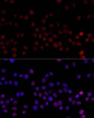 Immunocytochemistry/Immunofluorescence: hnRNP L Antibody [NBP3-03640] - Analysis of 293T cells using hnRNP L antibody at dilution of 1:100 (40x lens). Blue: DAPI for nuclear staining.